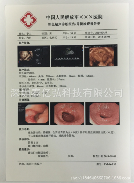 噴墨膠片 醫用膠片 超聲打印膠片四維彩超膠片180A3工廠,批發,進口,代購