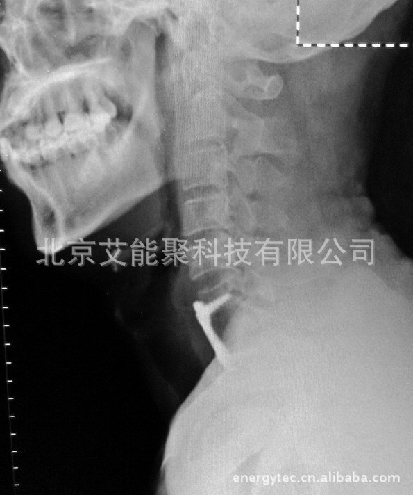 廠傢直銷，質優價廉醫用Ｘ光  B超膠片  歡迎來電咨詢采購工廠,批發,進口,代購