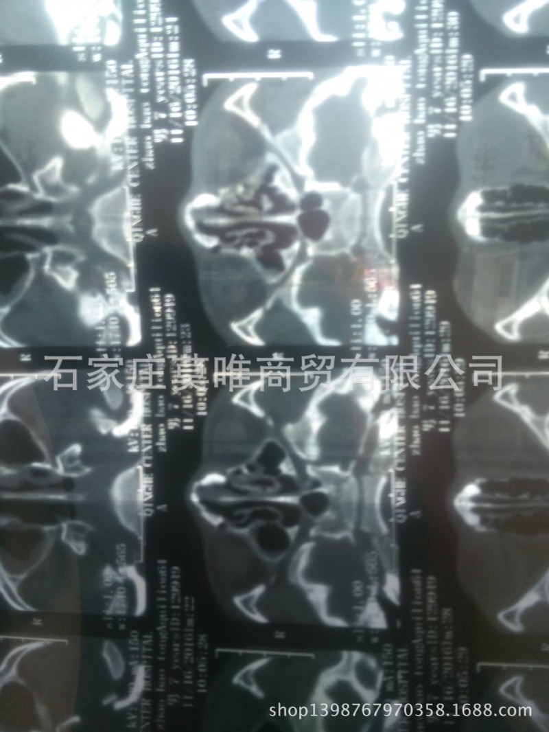 批發MDI-HTO-N型14X17規格的膠片批發・進口・工廠・代買・代購