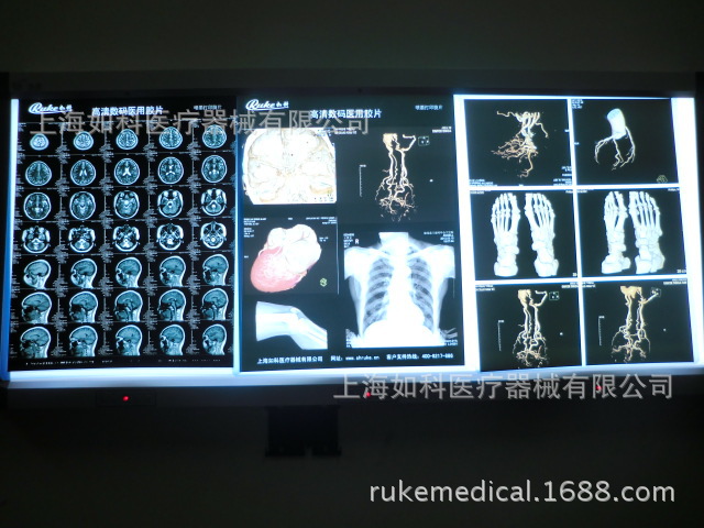 放射科 醫用膠片高清噴墨醫用膠片工廠,批發,進口,代購