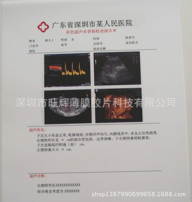 專業供應 激光打印膠片 醫用噴墨膠片工廠,批發,進口,代購