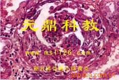大量供應優質出口生物顯微切片-新月體性腎小球腎炎工廠,批發,進口,代購