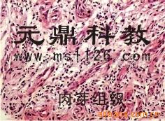 廠傢大量生產供應優質出口生物顯微切片-肉芽組織工廠,批發,進口,代購