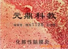 廠傢大量生產供應優質出口生物顯微切片-化膿性腦膜炎工廠,批發,進口,代購