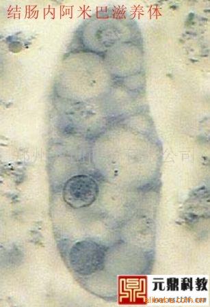 廠傢大量生產供應優質寄生蟲切片-結腸內阿米巴滋養體工廠,批發,進口,代購