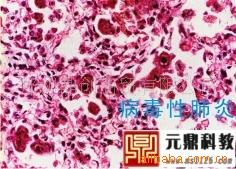 廠傢大量生產供應優質病理切片-病理性肺炎工廠,批發,進口,代購