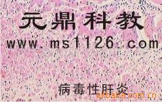 廠傢大量生產供應優質病理切片-病理性肝炎工廠,批發,進口,代購