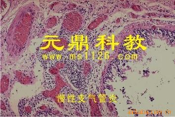 大量供應優質出口生物顯微切片-慢性支氣管炎工廠,批發,進口,代購