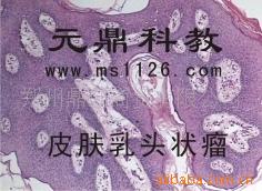 廠傢大量生產供應優質病理切片-皮膚乳頭狀瘤工廠,批發,進口,代購