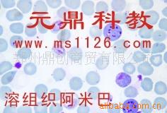 廠傢大量生產供應寄生蟲切片-溶組織阿米巴工廠,批發,進口,代購