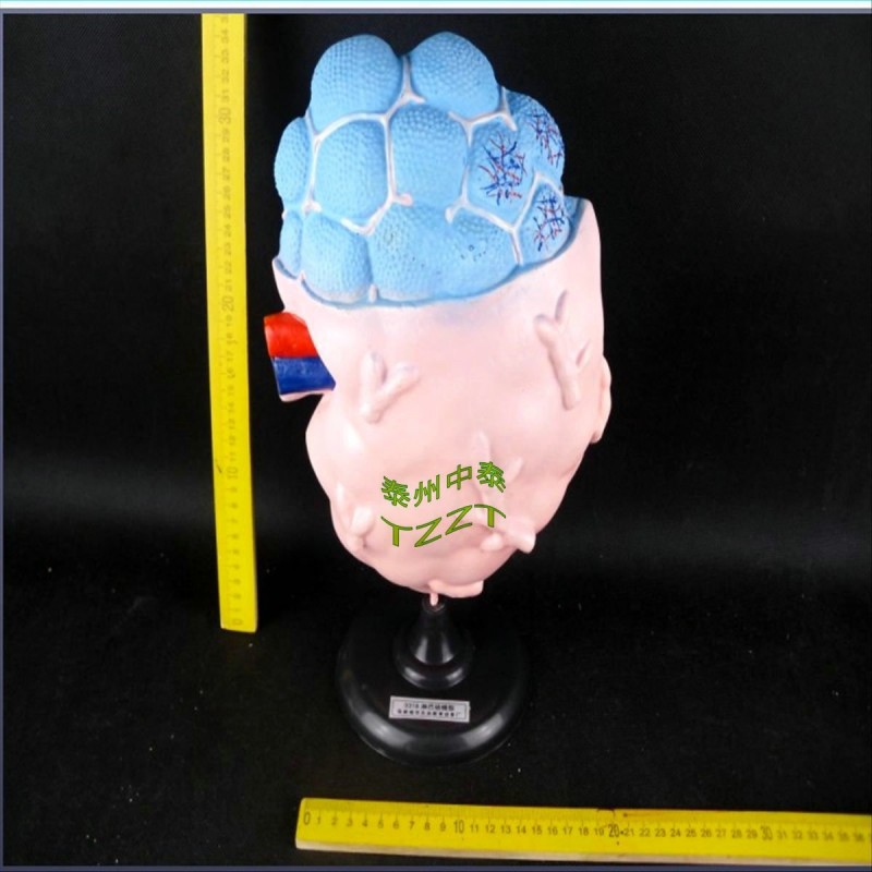 【教學機器專賣】淋巴結模型 J3318 初中、高中生物實驗器材工廠,批發,進口,代購