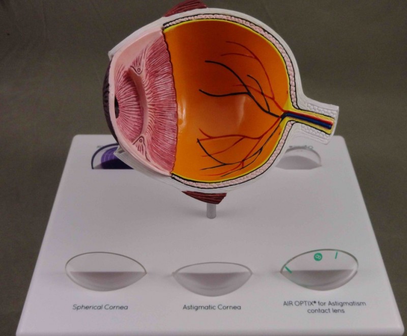 青光眼模型, 眼球模型,病變眼膜模型,眼角膜批發・進口・工廠・代買・代購