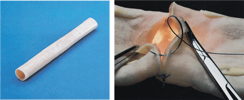 腸管吻合模型，腸管縫合模具批發・進口・工廠・代買・代購