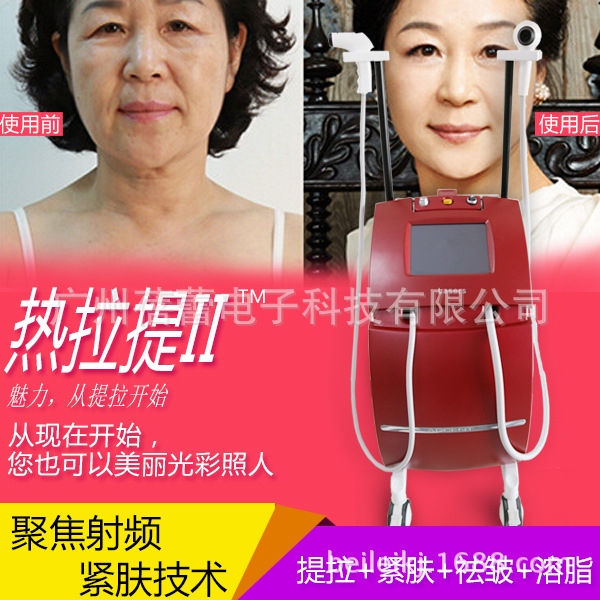 熱拉提臉部抗衰美容機器 無創緊膚 以色列深藍射頻美容院必備工廠,批發,進口,代購