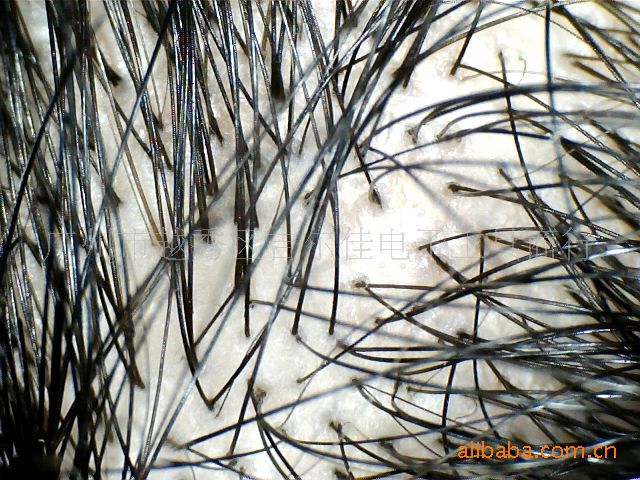 200倍皮膚毛發毛囊檢測機批發・進口・工廠・代買・代購